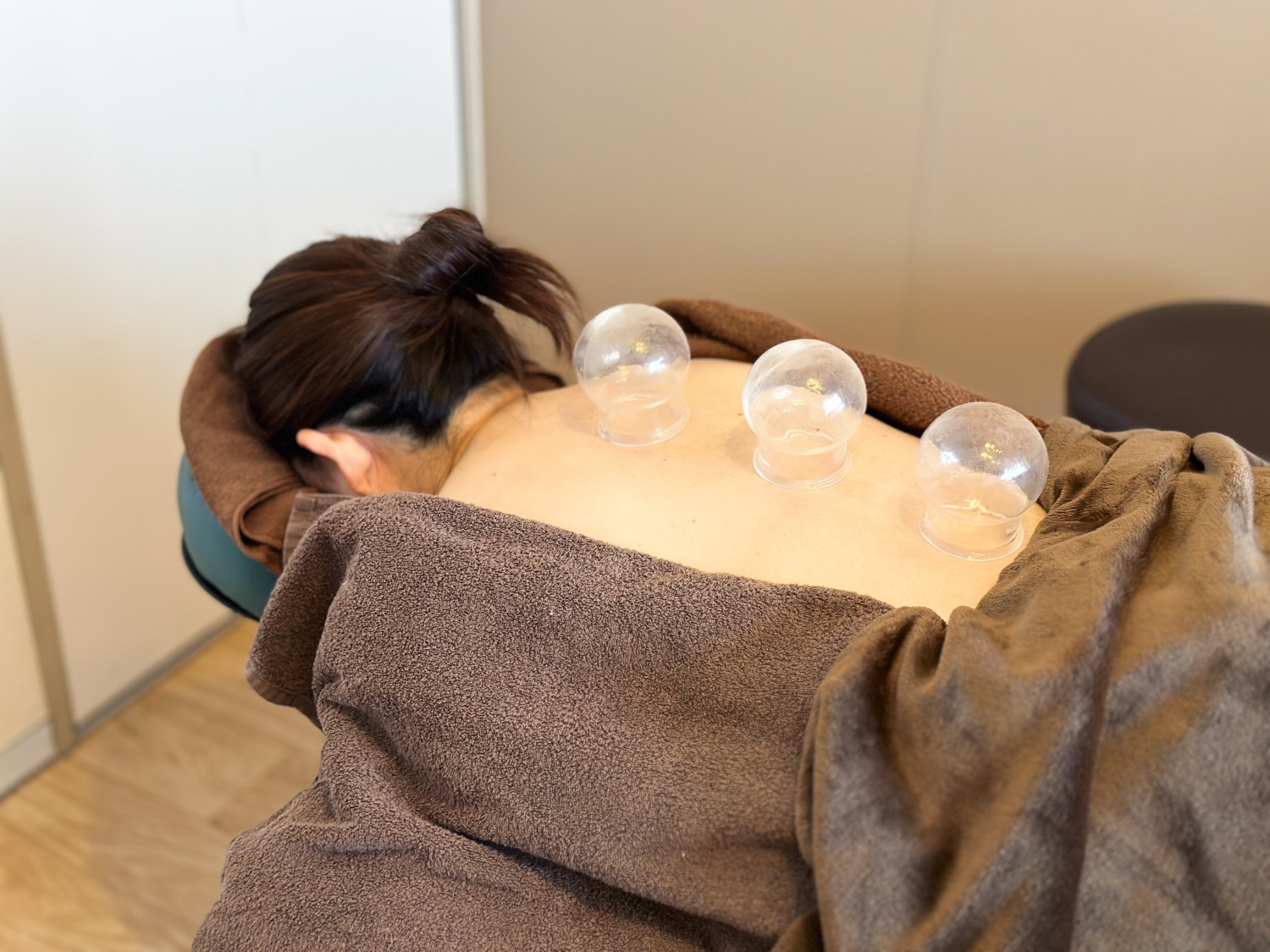 En鍼灸治療院【女性限定/男性は紹介のみ】 本気の体質改善!漢方茶✖️鍼灸(美容鍼付)吸い玉✖️ハーブテントでまるごとボディケアのメニュー画像