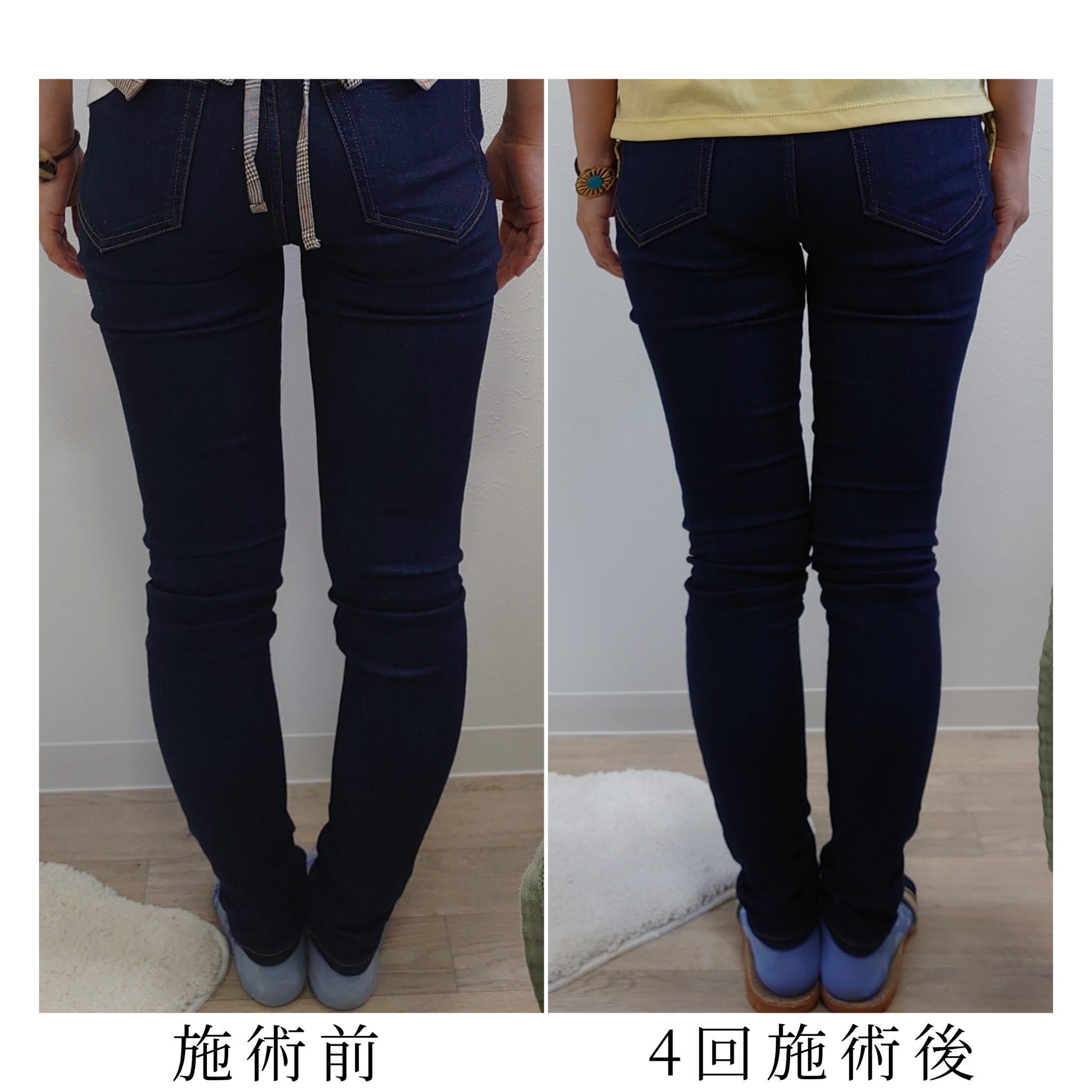 Total Care Sora 産後骨盤矯正VIP【新規限定価格】のメニュー画像