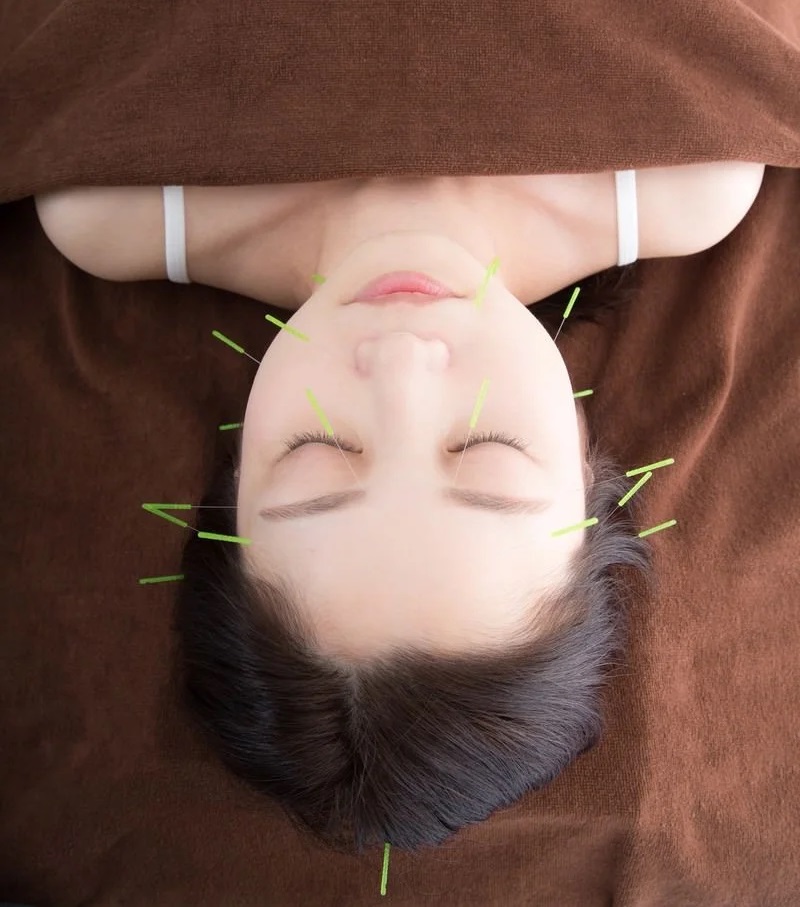 なかむら鍼灸整骨院 寝不足・疲れ・ストレス・モヤモヤするときに、、、　自律神経系改善コースのメニュー画像