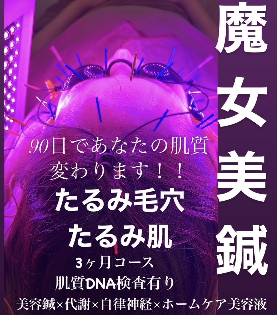 Panda鍼灸整体院(パンダ鍼灸整体院）ダイエット・美容鍼・育毛鍼 【5月残り3名様限定】プレミアム魔女美鍼　90日であなたの肌質を変えます！※お化粧を落としておこしください 初回体験¥7,980のメニュー画像