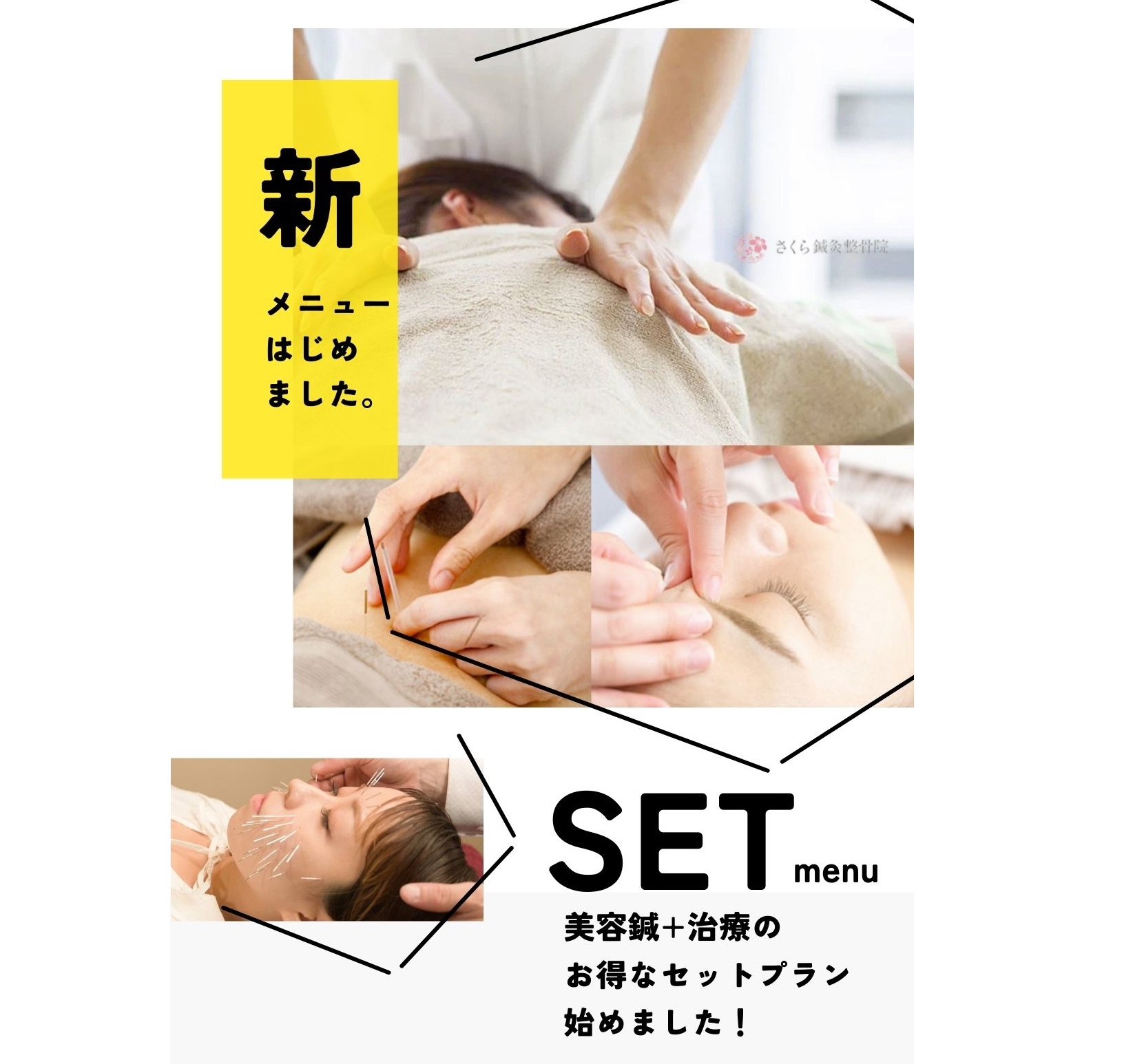 さくら鍼灸整骨院 今1番人気のメニューです【美容とお悩みの症状を同時にケア】本格的な鍼灸と美容鍼セットのメニュー画像