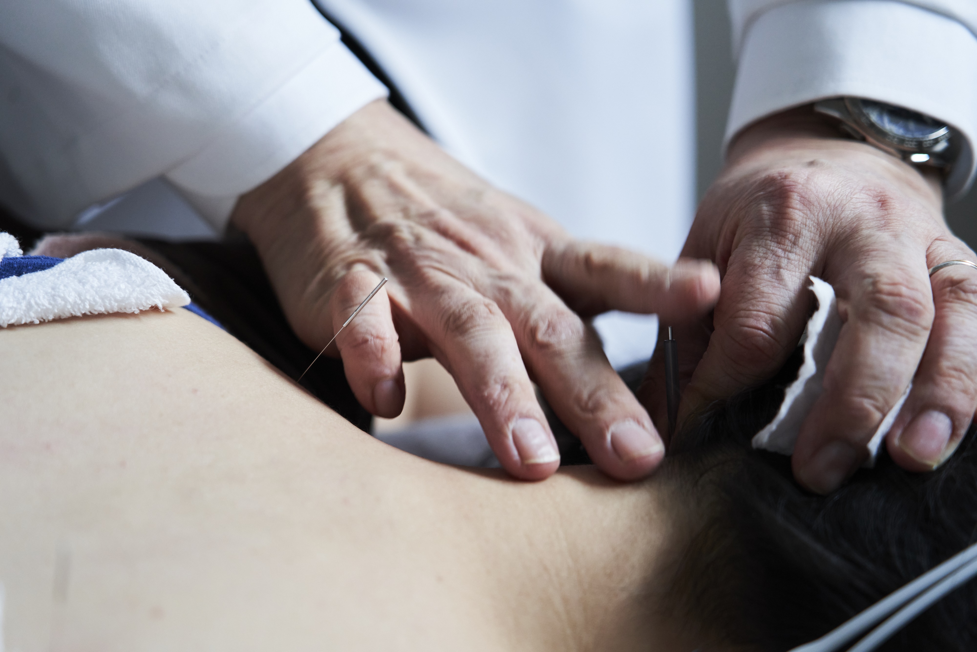 おおい鍼灸院 美容鍼のメニュー画像