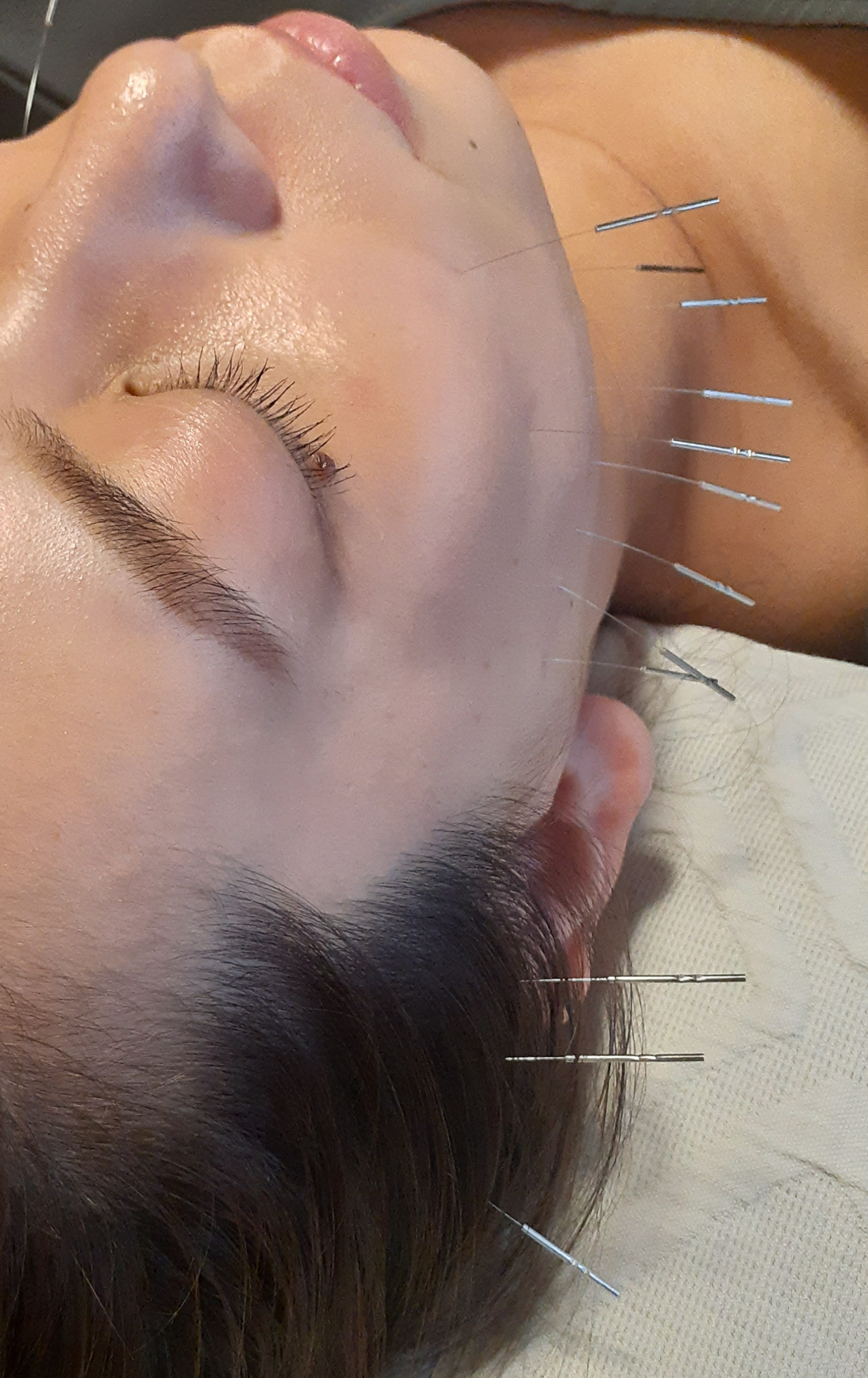 はりきゅう　環 立体造顔美容鍼®+全身治療のメニュー画像