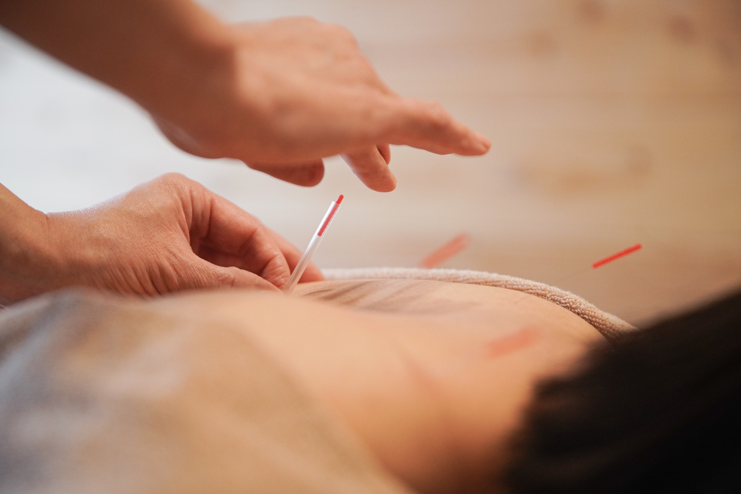 alba暁子鍼灸治療院 【再来限定】全身メンテナンスコース　【120分】のメニュー画像