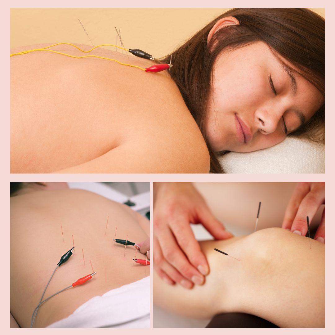 鍼灸Salon KUKUNA 小平店 【初診③】KUKU治療 30~40分(気になる1部位、電気治療可)のメニュー画像