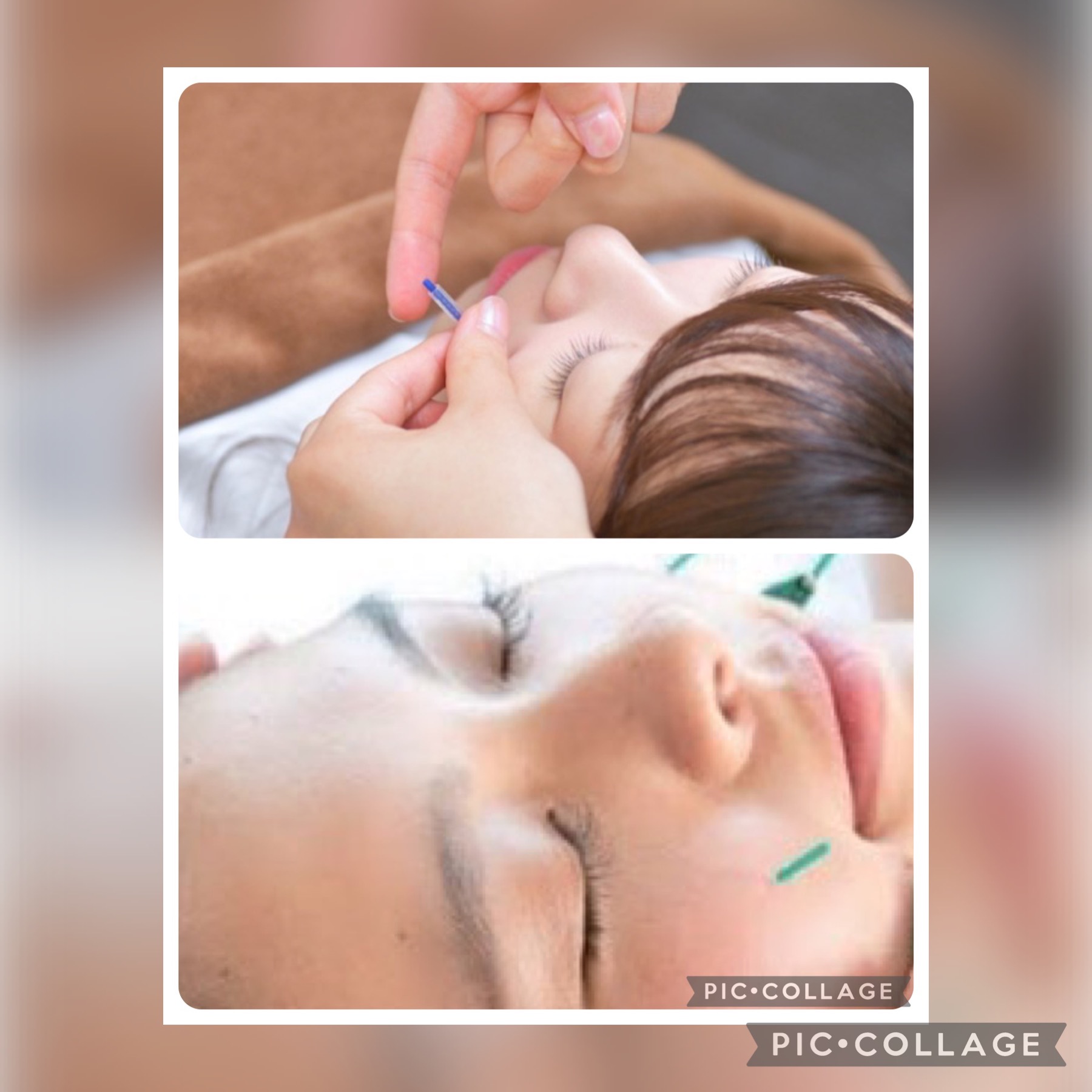OhanaRoom鍼灸治療院 総合美容鍼灸のメニュー画像