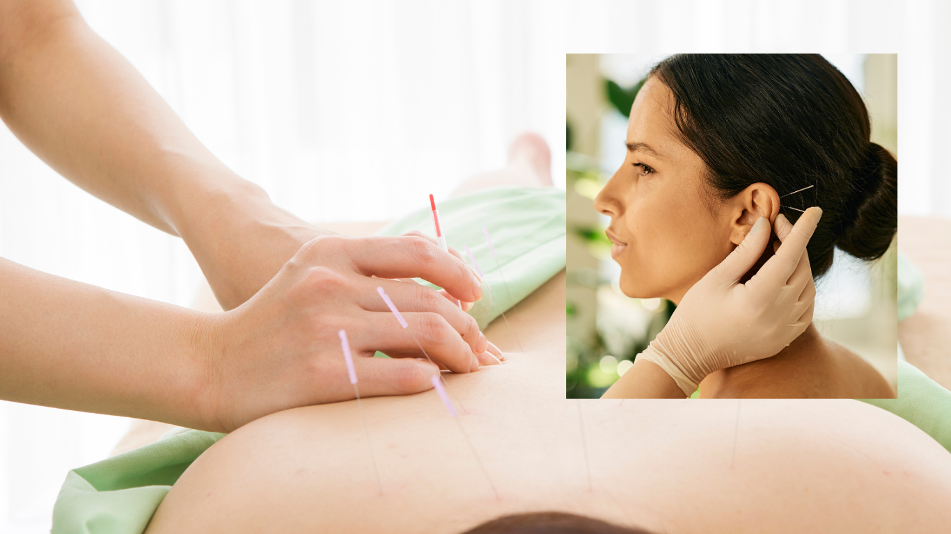 恵楽治療院 鍼灸治療（頭部又は体）のメニュー画像