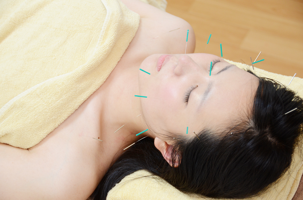 こもれび鍼灸院 美容鍼　目元スペシャル+お顔への鍼本数追加のメニュー画像