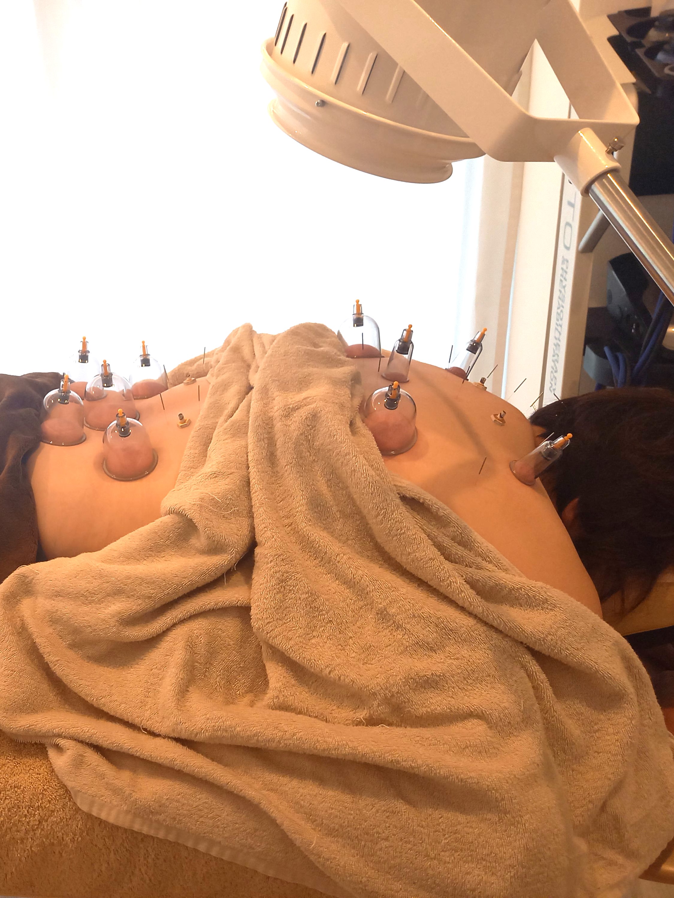 鍼灸salonzayon 全身鍼灸(骨盤矯正付き)のメニュー画像