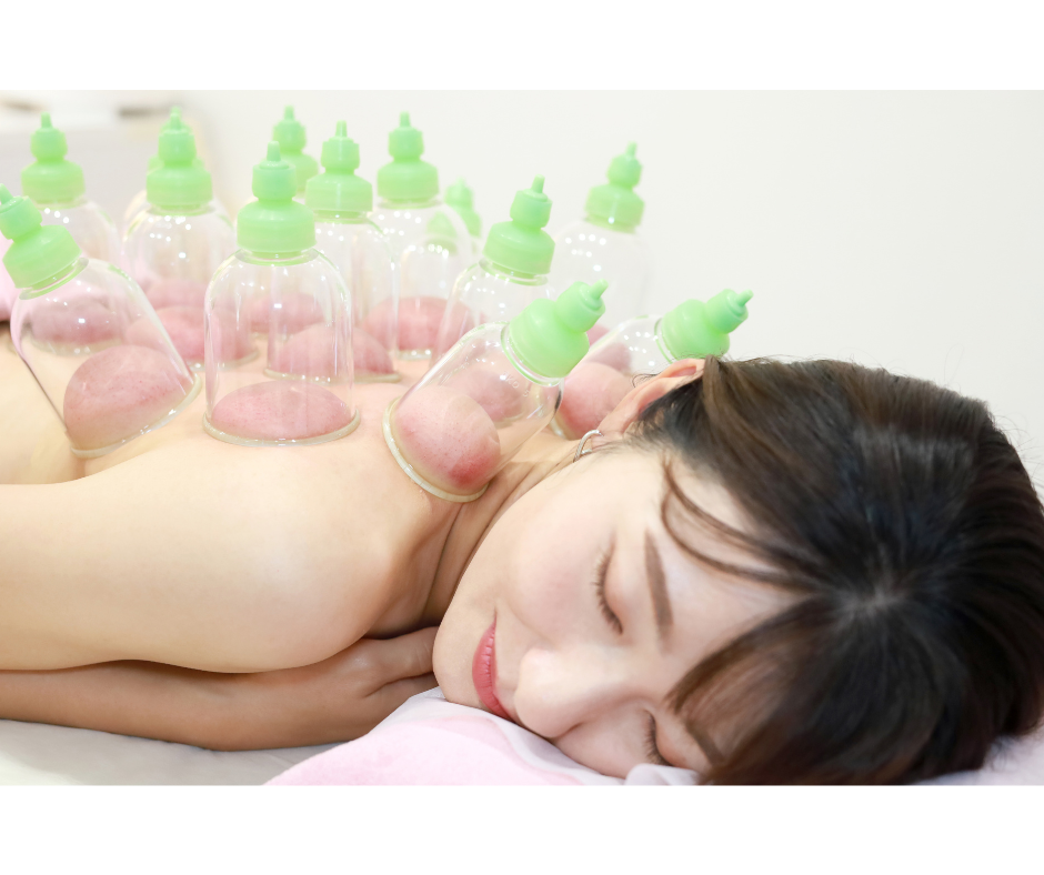 美容鍼灸サロン　Sachi-幸- 背中のカッピングのメニュー画像