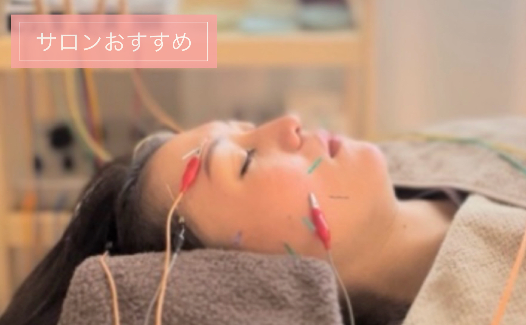 美容鍼こはりび こはりび美容鍼（７０分）【からだの土台から整える】のメニュー画像