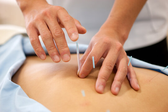 はりと灸　晴る 鍼灸施術　「お身体の痛みやコリ」「原因不明の不調」を整える！のメニュー画像