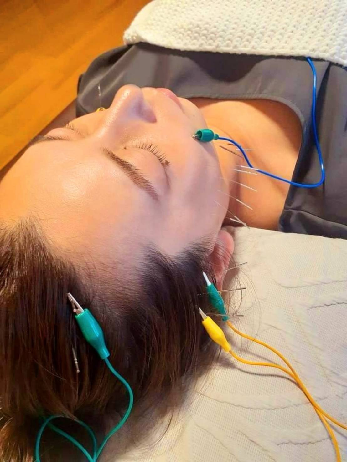 はりきゅう　環 【初回限定】　立体造顔美容鍼®＋全身治療のメニュー画像