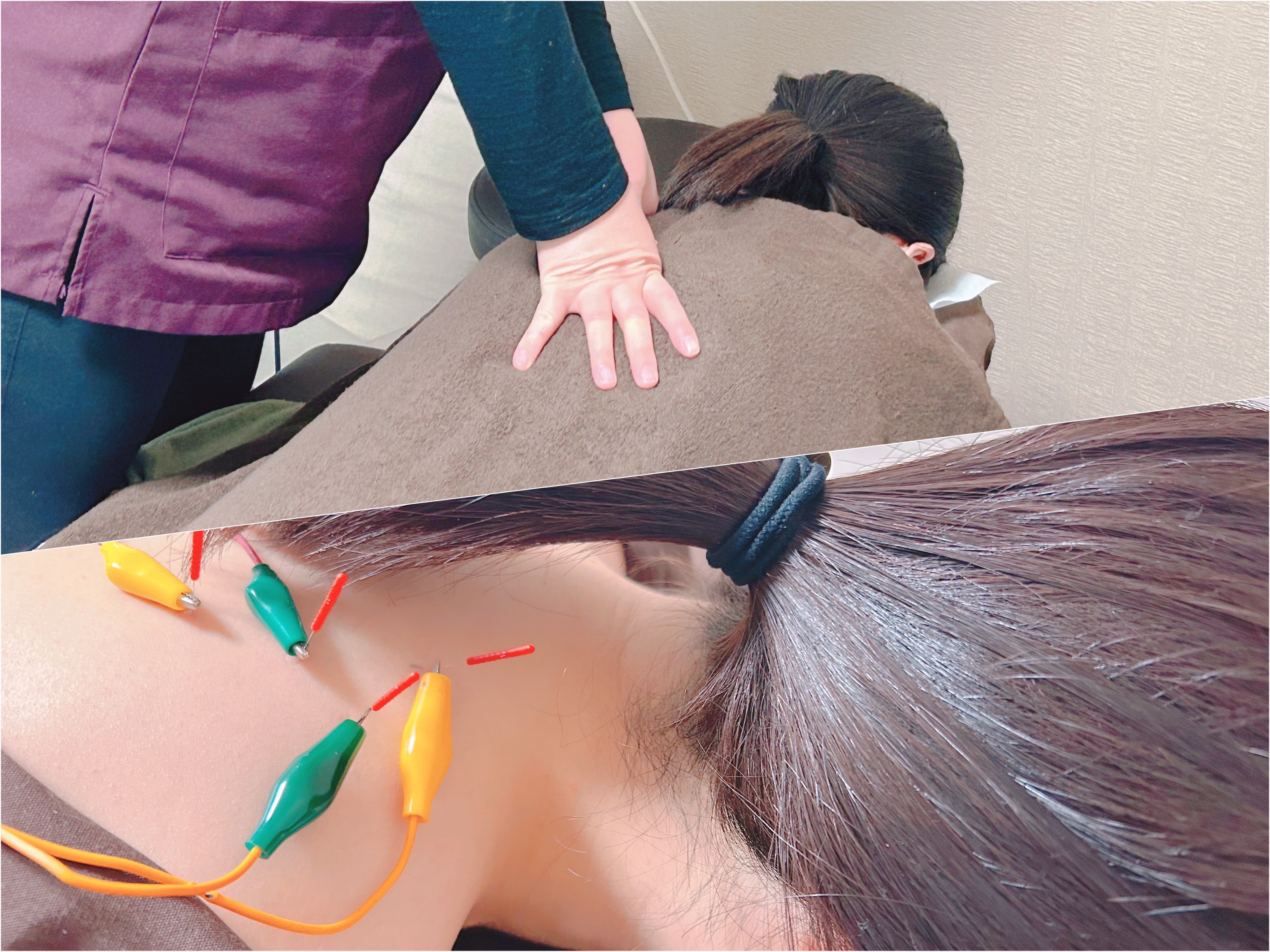 いずみ鍼灸マッサージ院 初回限定！【固まってた身体が軽くなる♪】指圧マッサージ×鍼灸のメニュー画像