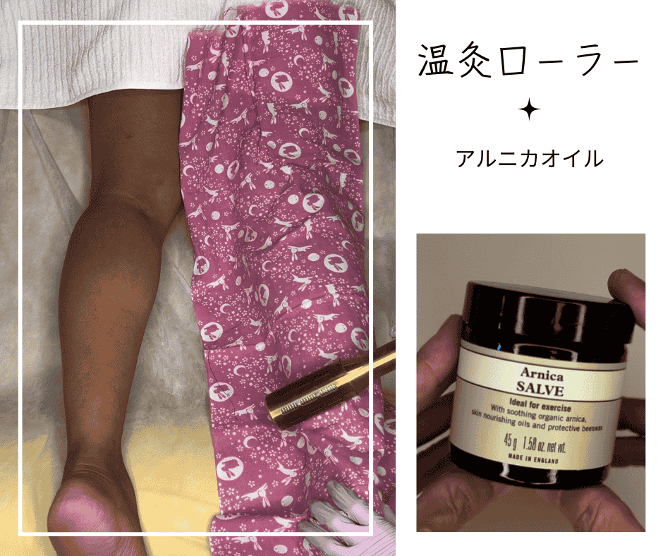 棗鍼灸治療院 脚の温灸ローラー施術+アルニカオイルのメニュー画像
