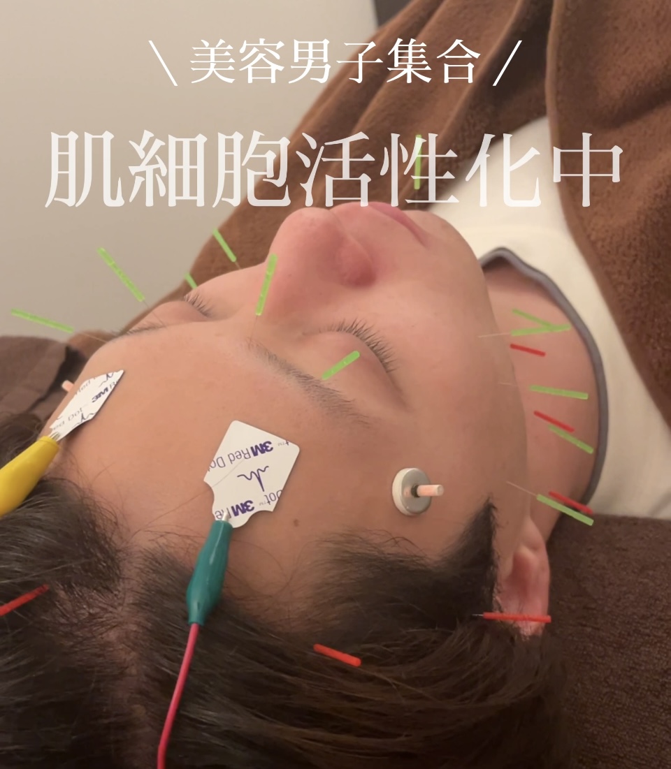 男性専門　美容　育毛・発毛鍼灸院　はり灸サロンrobust 美容はり灸のメニュー画像