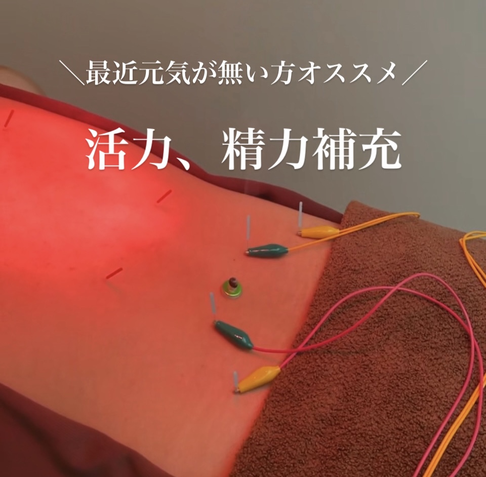 男性専門　美容　育毛・発毛鍼灸院　はり灸サロンrobust 活力アップはり灸のメニュー画像