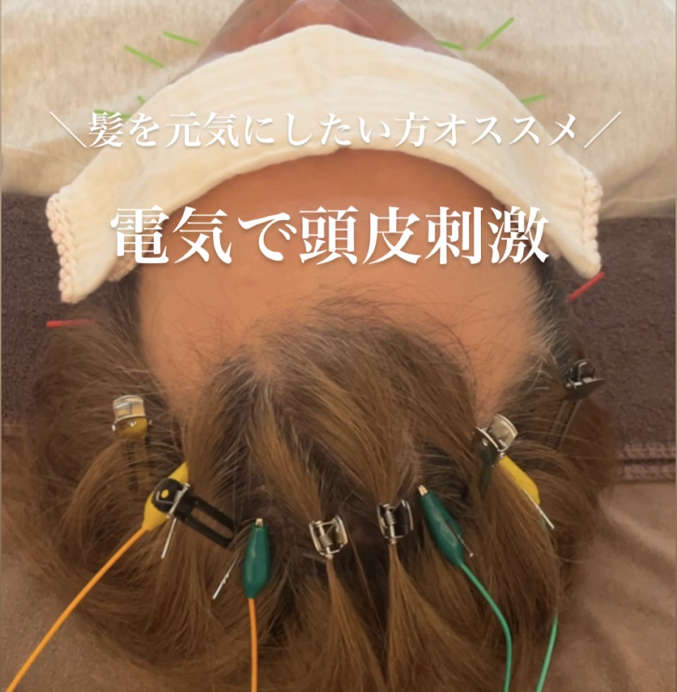 男性専門　美容　育毛・発毛鍼灸院　はり灸サロンrobust 育毛はり灸のメニュー画像