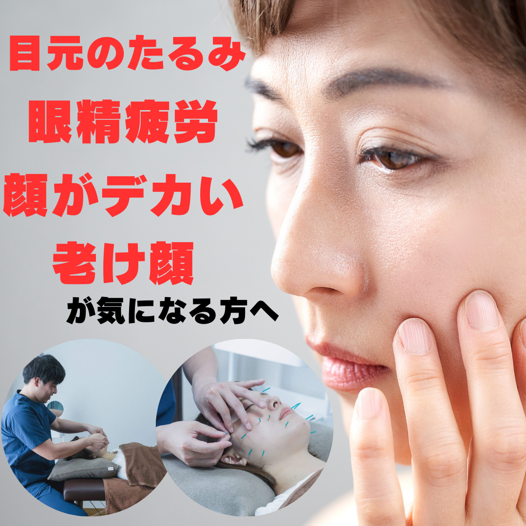 鍼灸整体サロンねこのひげ 【食いしばり・むくみ改善でスッキリ！】美顔鍼×小顔整体のメニュー画像