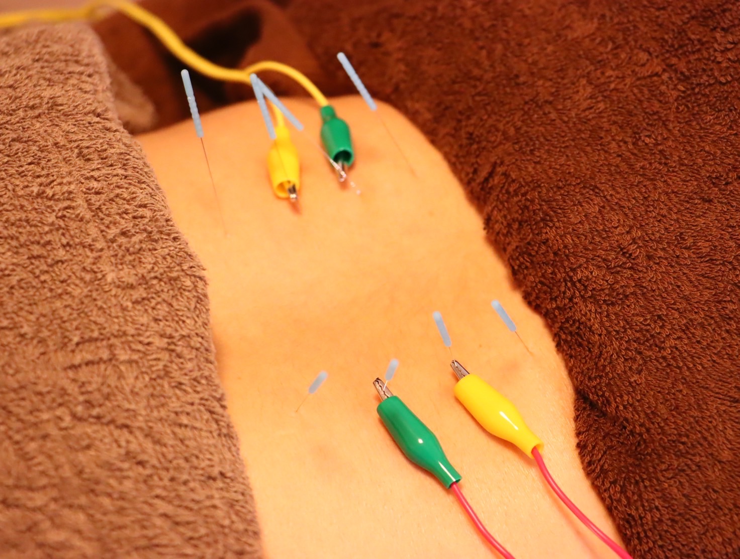 はりきゅうボディケアmalu 身体の鍼灸×整体　オーダーメイド施術　60~70分のメニュー画像