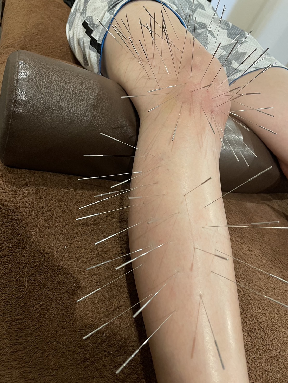 鍼灸整骨院拓【ルート治療院】 学生ルート治療のメニュー画像