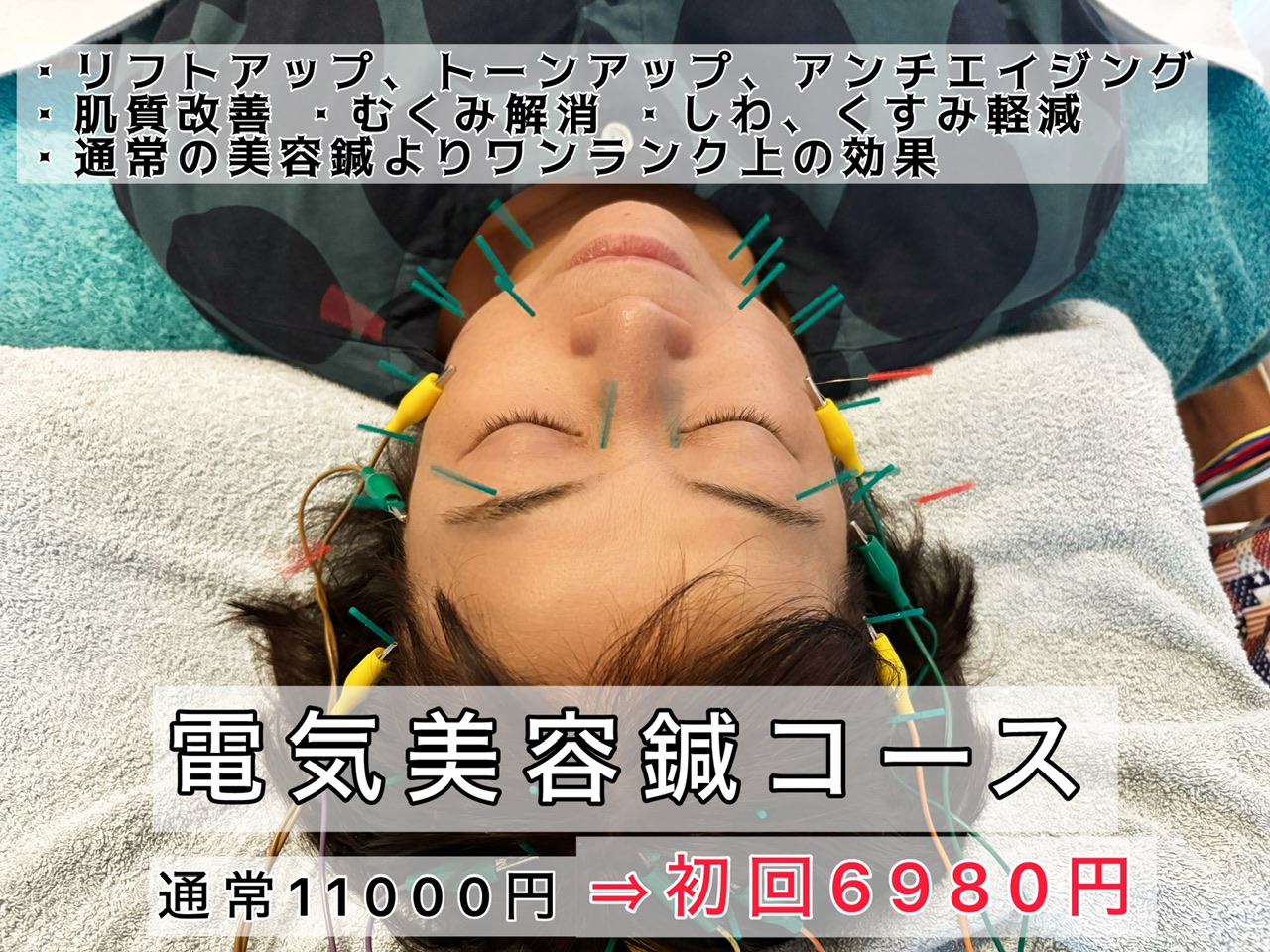 鍼灸マッサージ院 Monet 【初回限定】電気美容鍼コースのメニュー画像