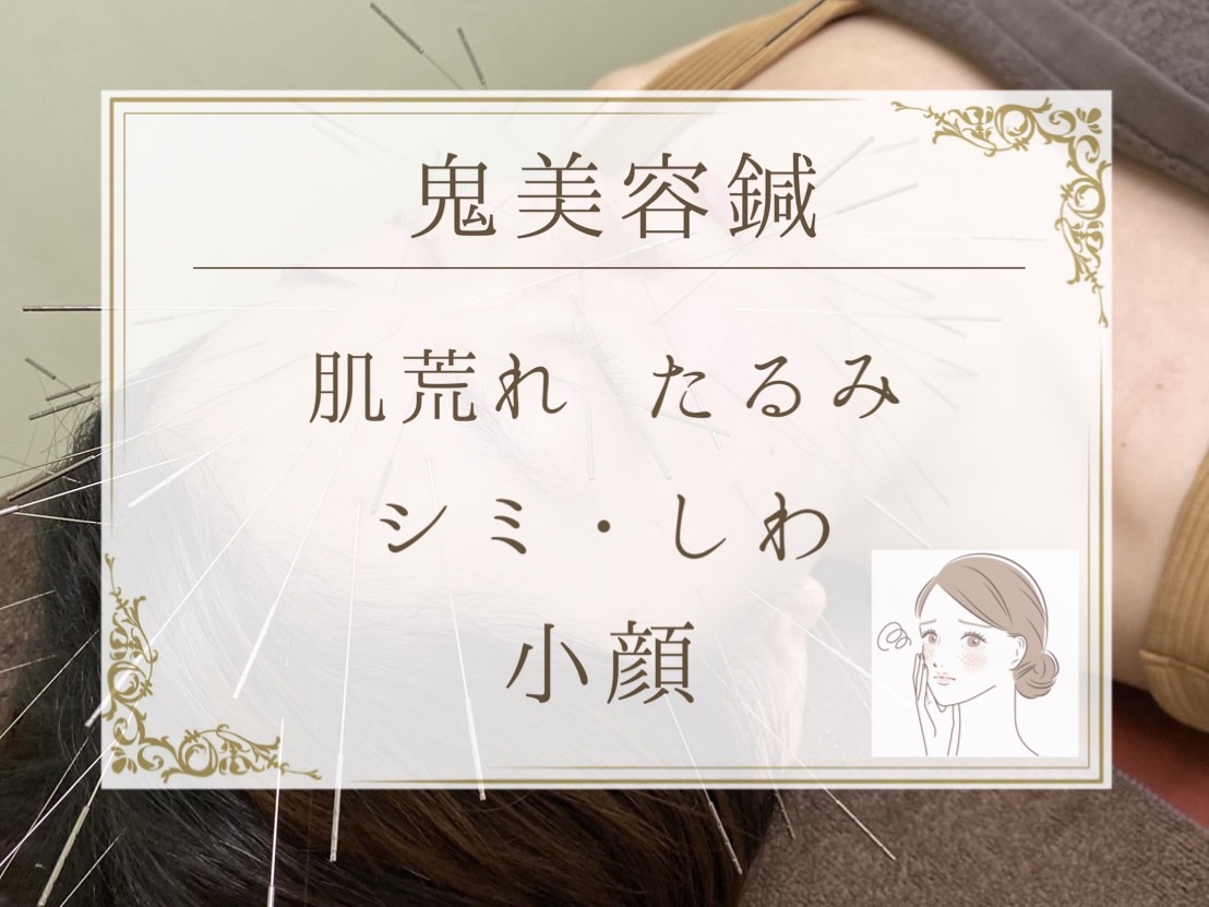 おおつか鍼灸接骨院~ルート治療認定院~ ルート治療鬼美容鍼 のメニュー画像