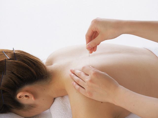 レディース鍼灸治療院Sis. 近鉄奈良駅前院 自律神経メンタル治療のメニュー画像