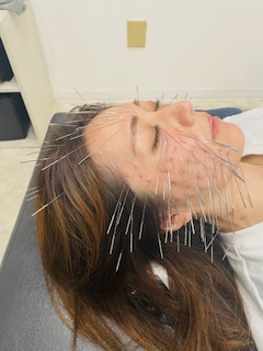 鍼処NAKAGAWA 伊吹度治療 顔集中毒だし美容鍼のメニュー画像