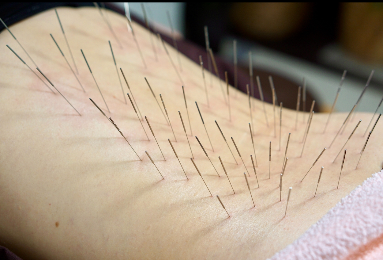 ハリ・イヅミ ルート治療60分（全身の様々な症状に）のメニュー画像