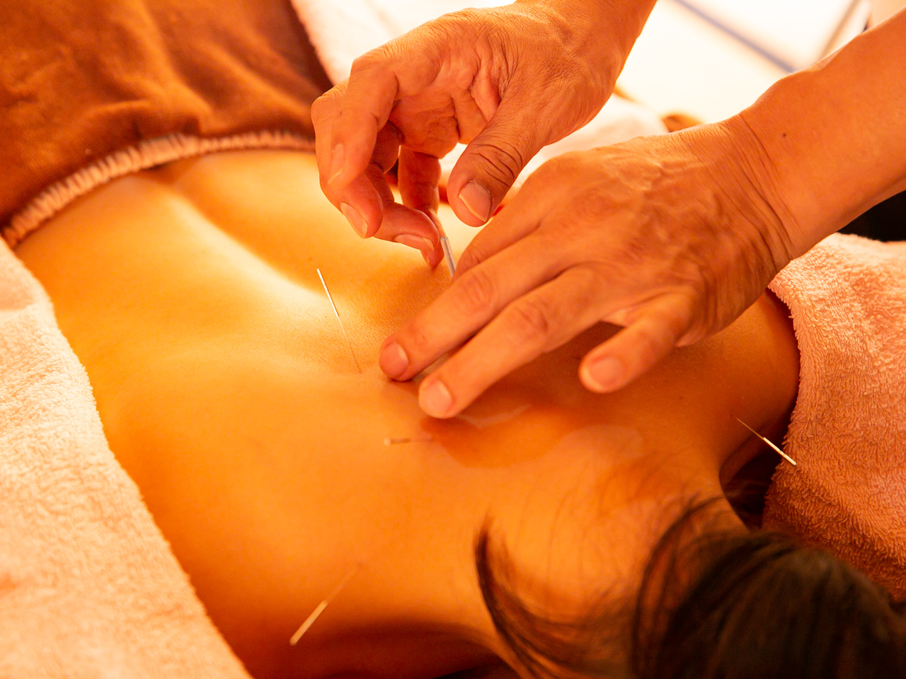 ラメール鍼灸院 【美容鍼】ダイエット美容鍼♪全身のコリに合わせてオーダーメイド施術★のメニュー画像