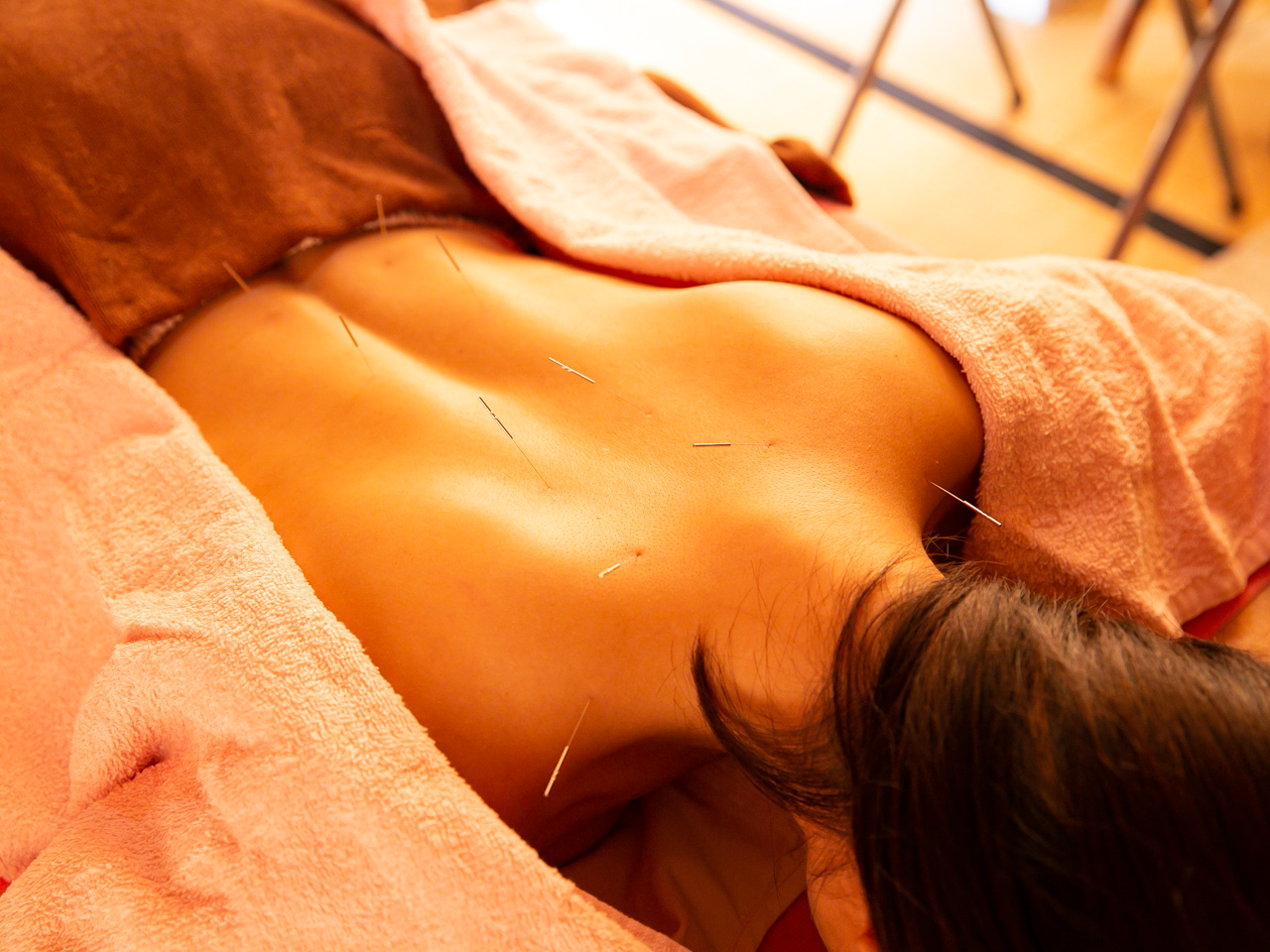 ラメール鍼灸院 『鍼灸』たっぷりのお任せ鍼灸６０分のメニュー画像