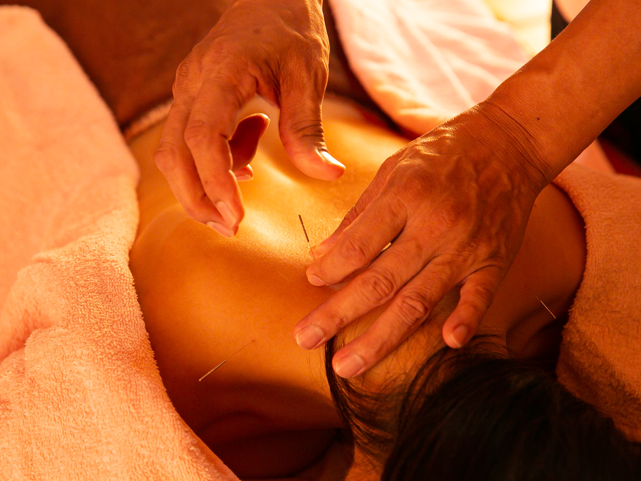 ラメール鍼灸院 『鍼灸』鍼灸初心者お任せ鍼灸３０分のメニュー画像