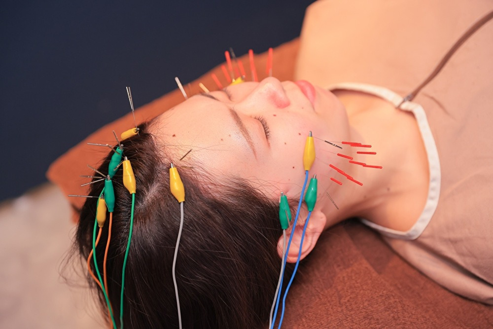 鍼灸サロン　孔-KOH- 「初回の方はこちら」アンチエイジング美容鍼コースのメニュー画像