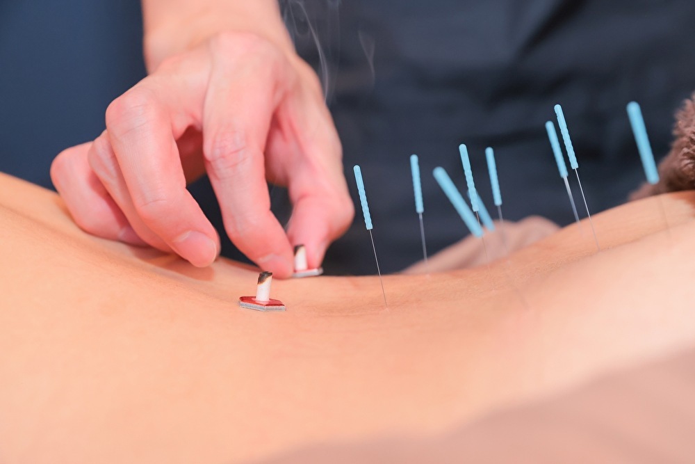 鍼灸サロン　孔-KOH- 「初回の方はこちら」全身鍼灸治療のメニュー画像