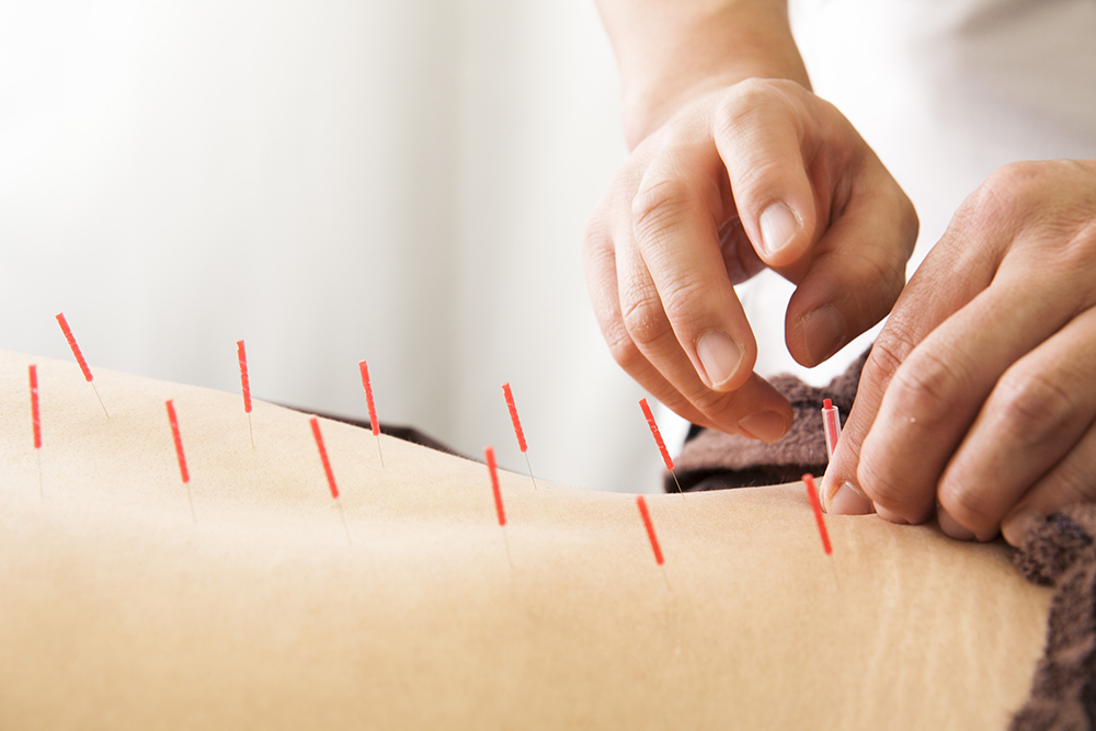 Owl治療室 基本鍼灸コースのメニュー画像