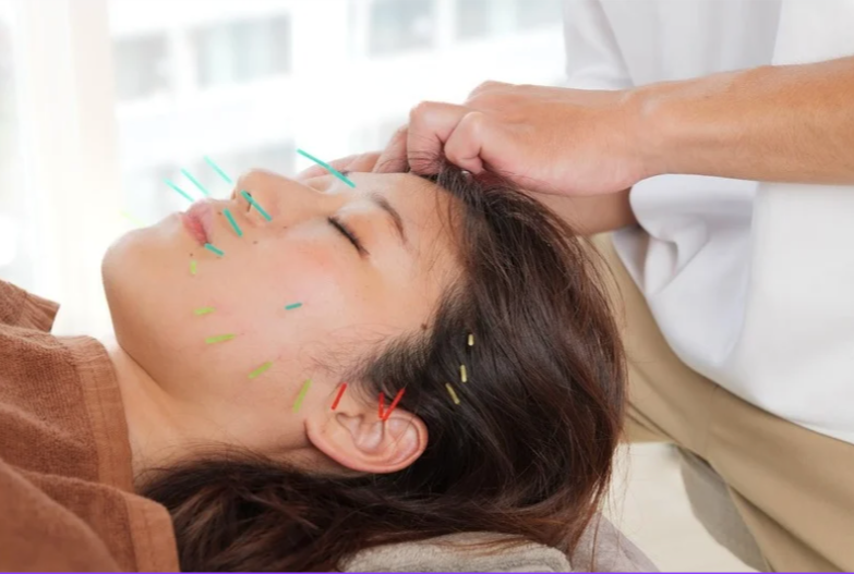 HAUOLA パーソナル鍼灸整体ジム 恵比寿2 【初回限定】HAUOLA式FIVEセオリー施術（お顔周りのお悩みコース）のメニュー画像