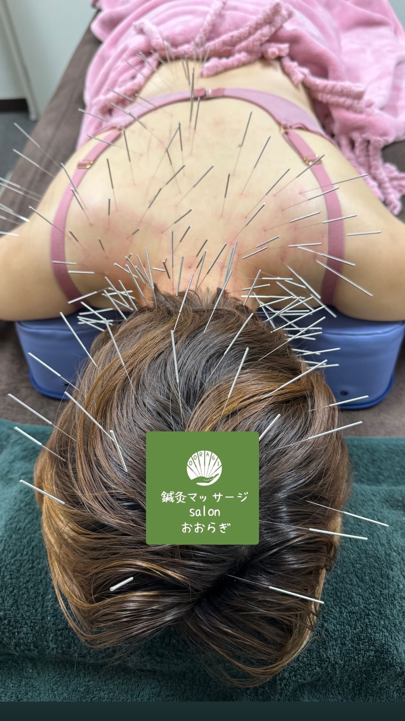 鍼灸マッサージsalonおおらぎ【ルート治療専門】北心斎橋院 NEW！ルート治療60分（2025年より新規・リピーターの方）のメニュー画像