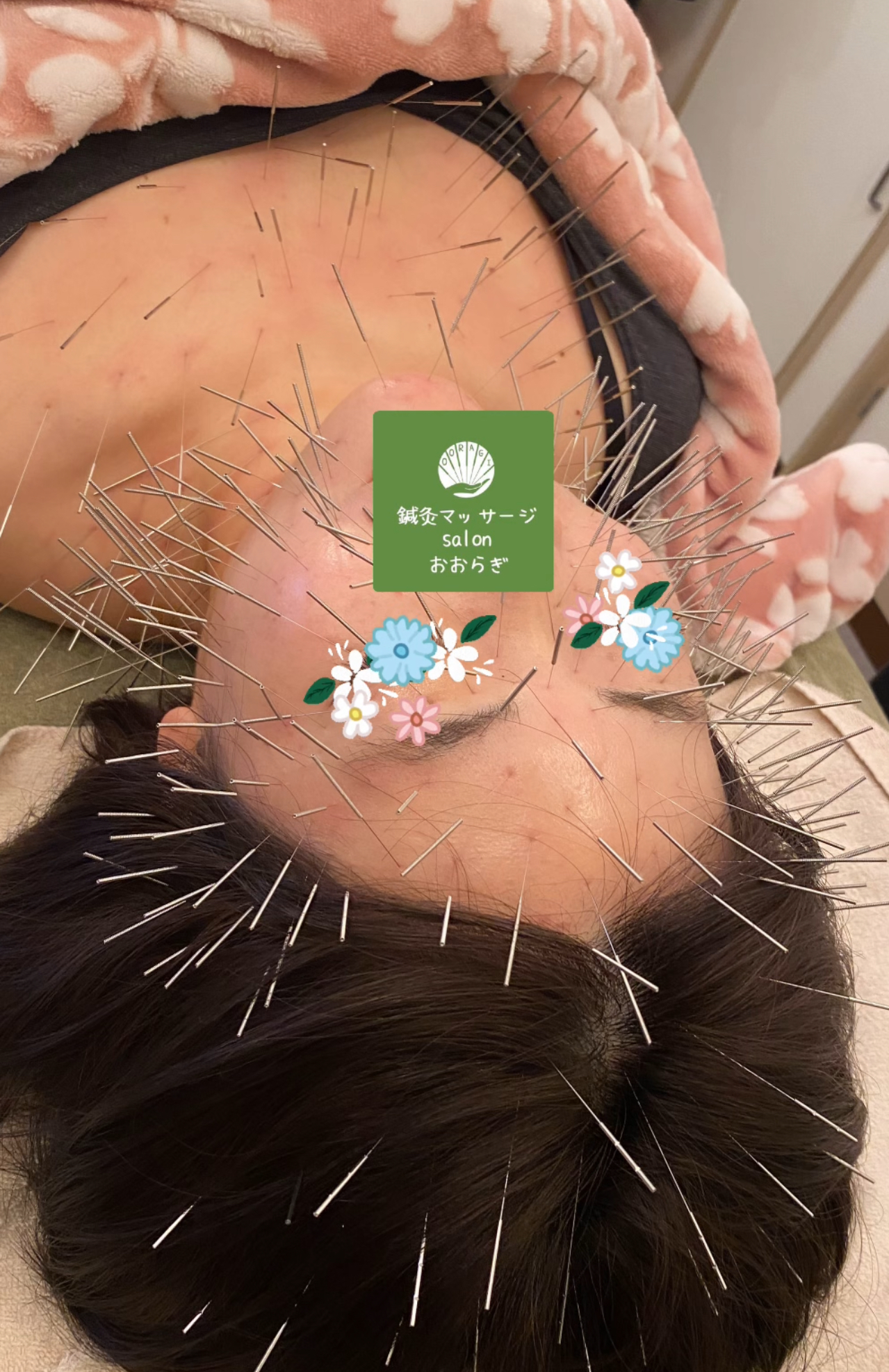 鍼灸マッサージsalonおおらぎ【ルート治療専門】北心斎橋院 NEW！ルート治療80分（2025年以降スタートの患者様)のメニュー画像