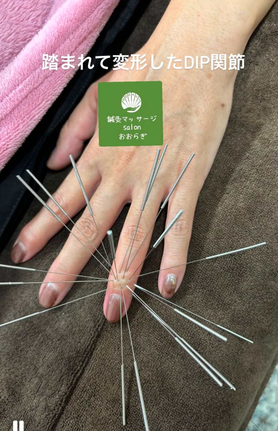 鍼灸マッサージsalonおおらぎ【ルート治療専門】寝屋川院 ルート治療30分(2024年末以前のリピーター様用)のメニュー画像