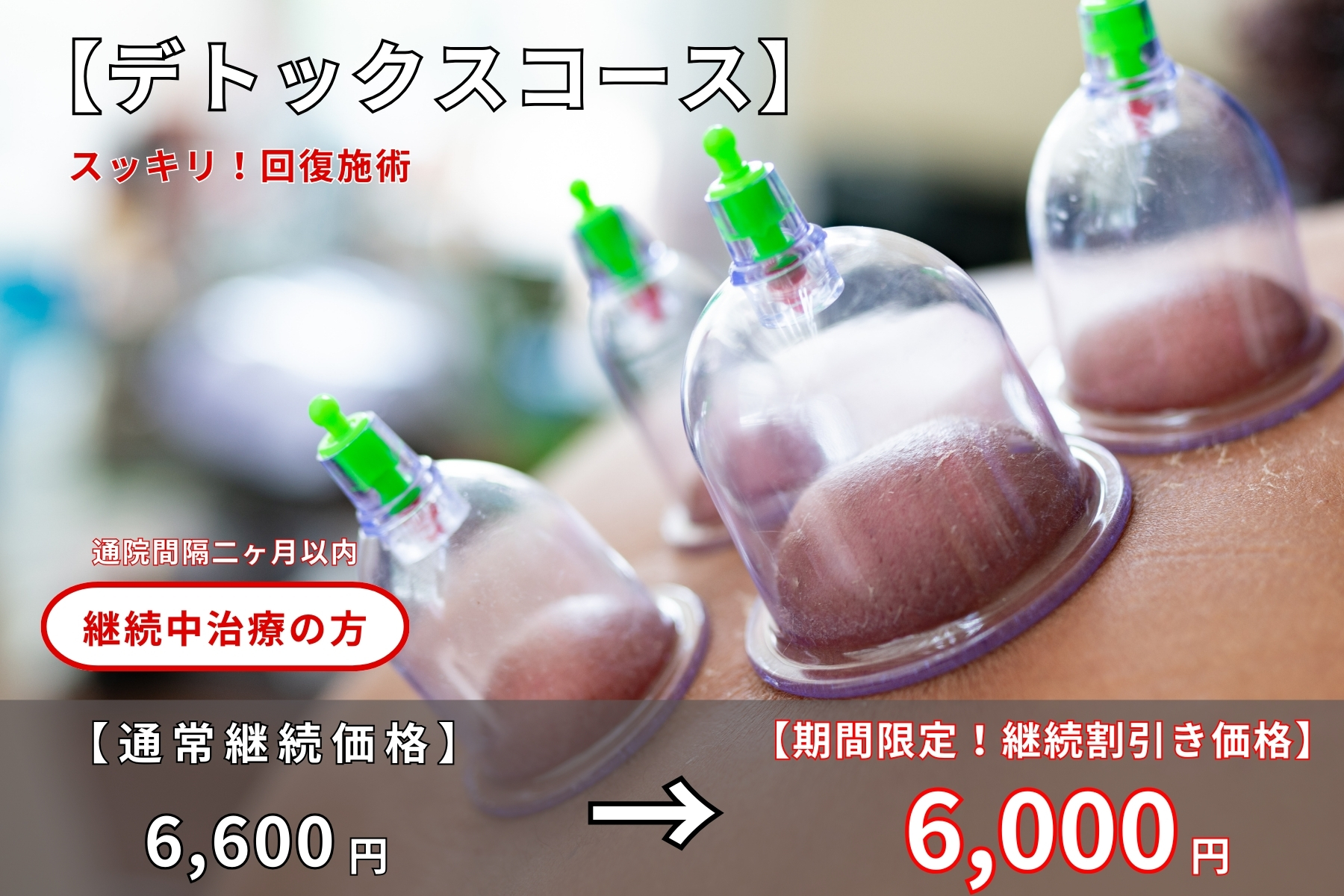 沖縄県那覇市首里スマイル鍼灸整骨院　本院 二か月以内の継続通院の方｜期間限定の継続の方割引キャンペーン！通常継続価格が6600円→6000円継続中の方【口コミ評判優良コース】毎月１回の施術がおススメ。デトックス治療はスッキリしてやみつきのメニュー画像