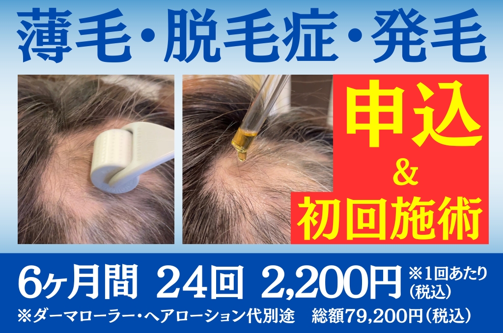 龍華鍼灸院 薄毛・脱毛症・発毛 6ヶ月間24回【初回】申込＆初回施術のメニュー画像