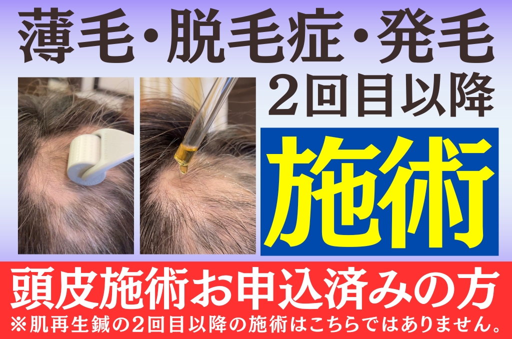 龍華鍼灸院 脱毛症・薄毛・発毛 6ヶ月間24回 2回目以降施術のメニュー画像