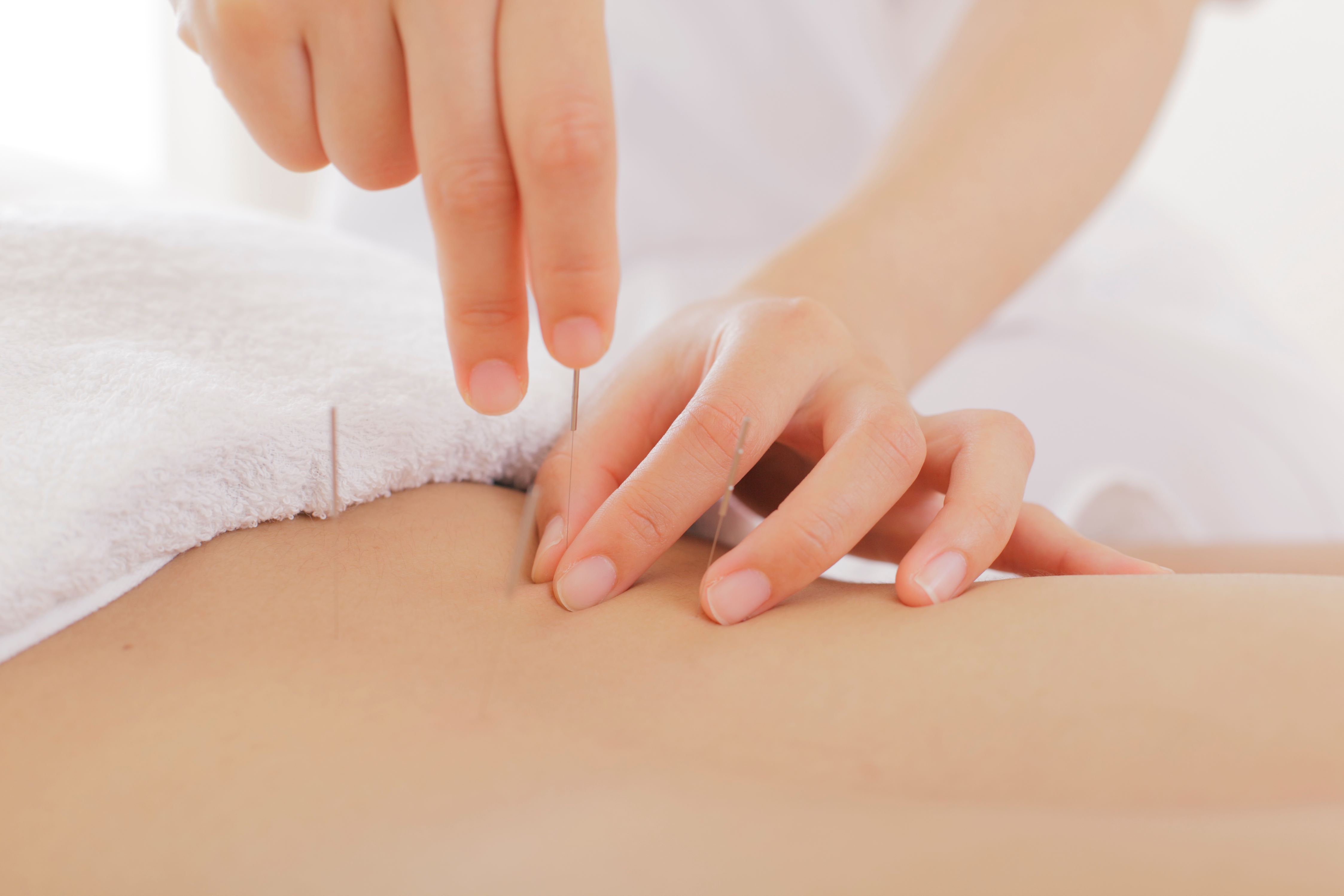 レディース鍼灸治療院Sis. 近鉄奈良駅前院 一般鍼灸治療（肩こり・腰痛・頭痛など）のメニュー画像