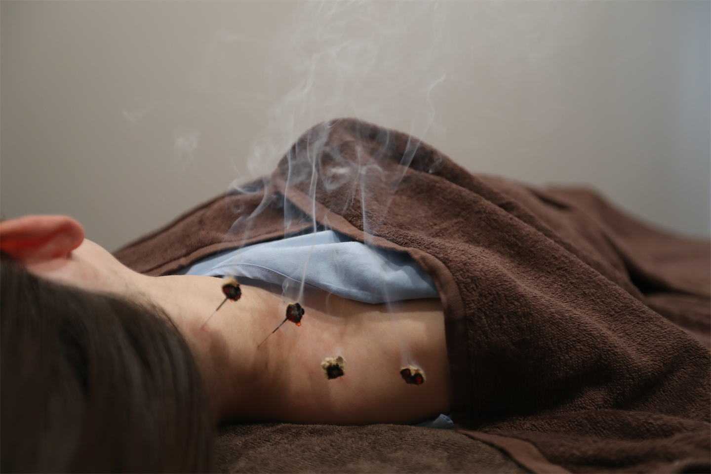 Ｔ はり と きゅう堂 お身体の鍼灸 50分のメニュー画像