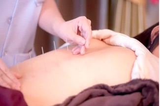 DRAGEE 【睡眠改善・自律神経ケア】鍼灸トリートメントのメニュー画像
