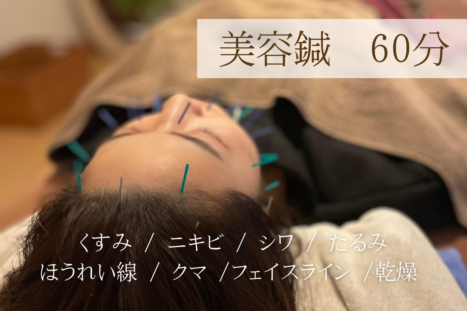 鍼灸マッサージサロン　Stock 【初回限定】美容鍼　60分のメニュー画像