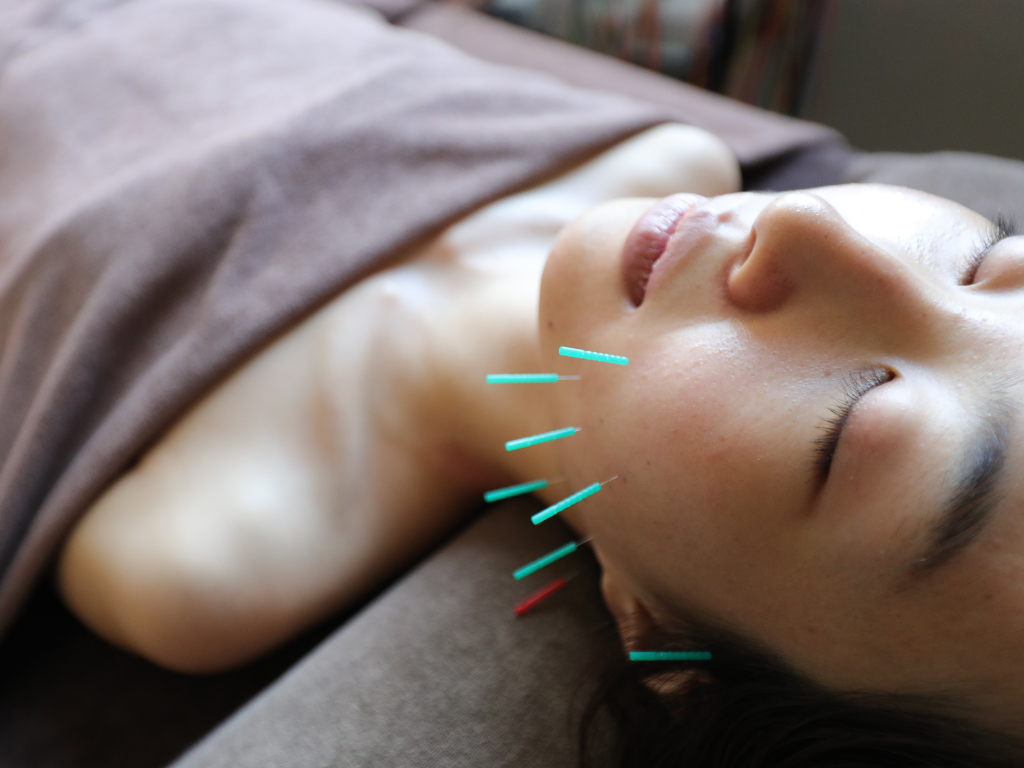 美容とカラダの鍼灸サロン やなけん 亀戸店 美容鍼+10本追加のメニュー画像