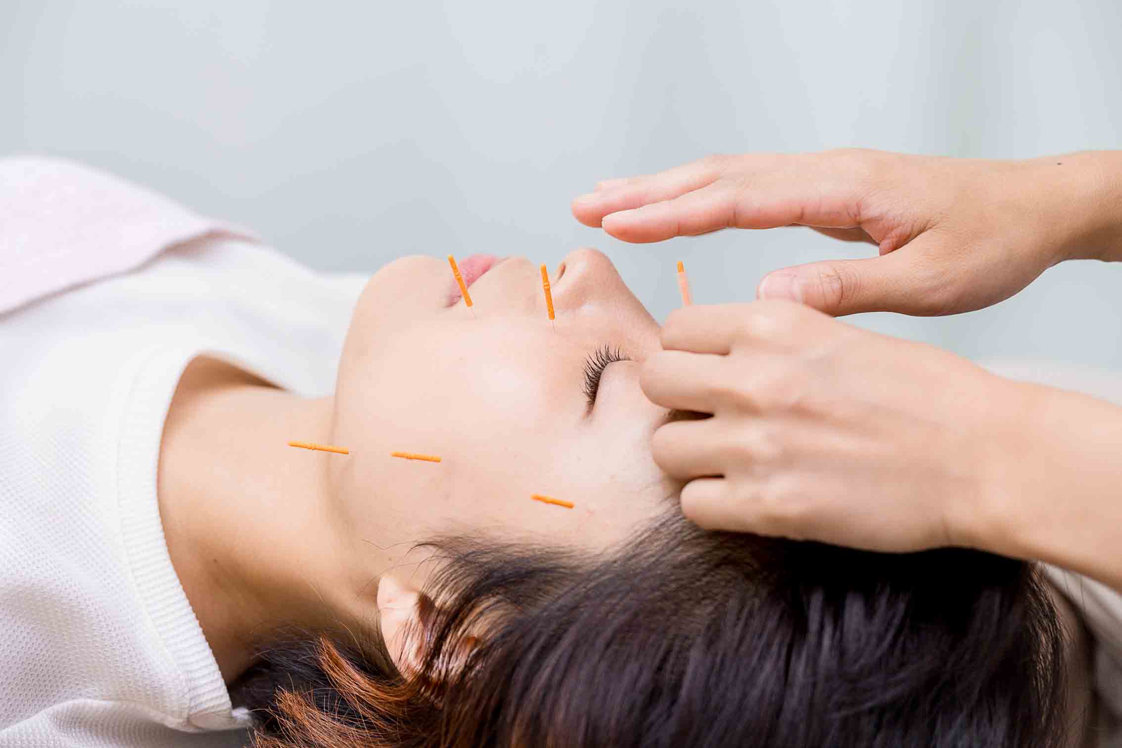 たいよう美容鍼灸院 川口院 人気No,１♪ほうれい線・リフトアップに！フェイシャル+美容鍼+EMSのメニュー画像