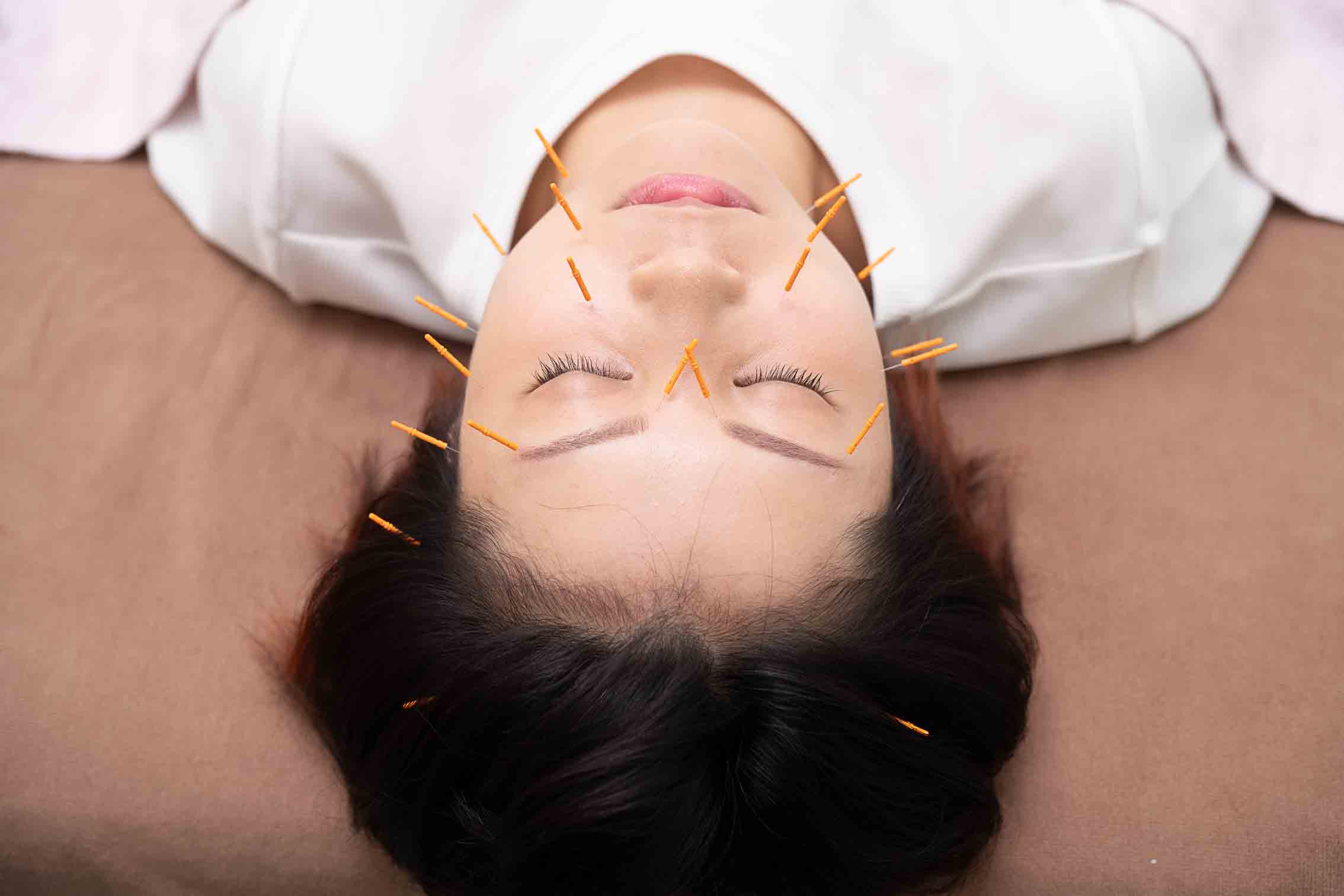 たいよう美容鍼灸院 川口院 人気No,2♪肌質改善・ほうれい線に！　フェイシャル＋美容鍼のメニュー画像